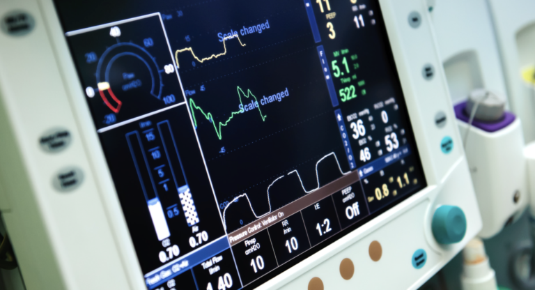 Mechanical Ventilation