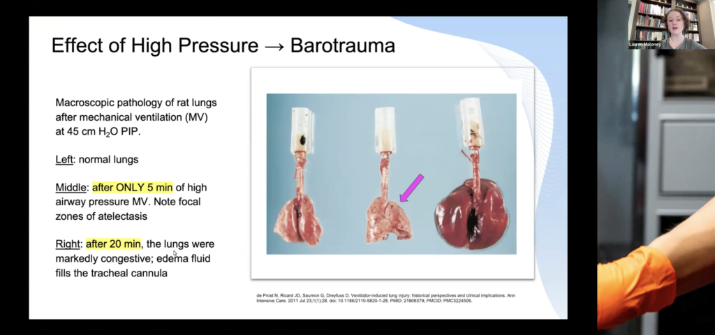 Image shows a snippet of Dr Maloney speaking to Barotrauma on SafeBVM's Manual Ventilation Workshop