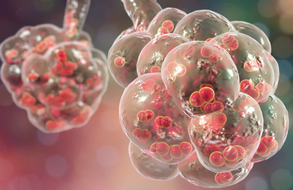 Alveolar Hypoventilation: In Depth Clinical Perspectives from Dr. Arthur Slutsky